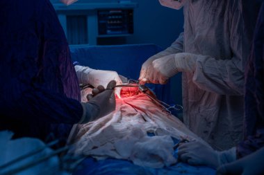 Hastane, cerrah, ameliyat, ameliyat, doktor, cerrahi, hasta, ilaç, kişi, hemşire, sağlık, takım çalışması, mide ameliyatı.