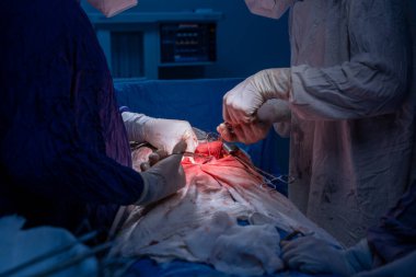 Hastane, cerrah, ameliyat, ameliyat, doktor, cerrahi, hasta, ilaç, kişi, hemşire, sağlık, takım çalışması, mide ameliyatı.