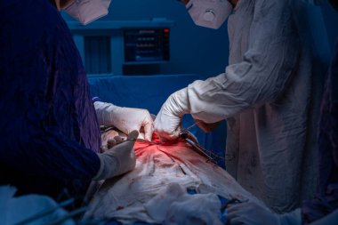 Hastane, cerrah, ameliyat, ameliyat, doktor, cerrahi, hasta, ilaç, kişi, hemşire, sağlık, takım çalışması, mide ameliyatı.