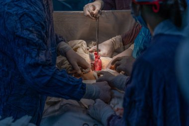 Bir grup cerrah bir hastaya ameliyat yapıyor. Cerrahlar hastanın hayatını kurtarmak için birlikte çalışırken atmosfer gergin ve ciddi.