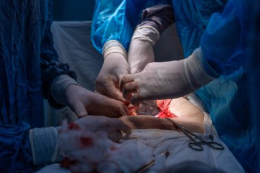 Bir grup cerrah bir hastaya ameliyat yapıyor. Cerrahlar görevlerine odaklandığı için sahne yoğun ve ciddi. Hasta savunmasız bir durumda.