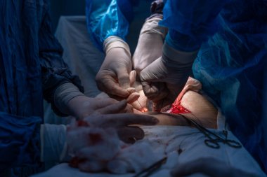 Bir grup cerrah bir hastaya ameliyat yapıyor. Cerrahlar görevlerine odaklandığı için sahne yoğun ve ciddi. Hasta savunmasız bir durumda.