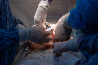 Bir grup cerrah bir hastaya ameliyat yapıyor. Cerrahlar görevlerine odaklandığı için sahne yoğun ve ciddi. Hasta savunmasız bir durumda.