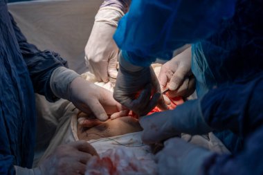 Bir grup cerrah bir hastaya ameliyat yapıyor. Cerrahlar görevlerine odaklandığı için sahne gergin ve ciddi. Hasta masanın üzerinde yatıyor.