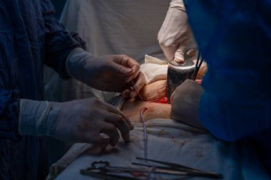 Bir cerrah bir hastaya ameliyat yapıyor. Cerrah görevine odaklandığı için sahne gergin ve ciddi. Odadaki diğer insanlar muhtemelen hemşireler ya da diğer sağlık görevlileri.