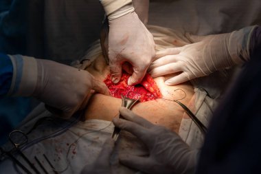 Bir grup cerrah bir hastaya ameliyat yapıyor. Cerrahlar görevlerine odaklandığı için sahne yoğun ve ciddi. Hasta çok acı çekiyor.