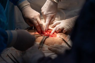 Bir grup cerrah bir hastaya ameliyat yapıyor. Cerrahlar görevlerine odaklandığı için sahne yoğun ve ciddi. Hasta savunmasız bir durumda.