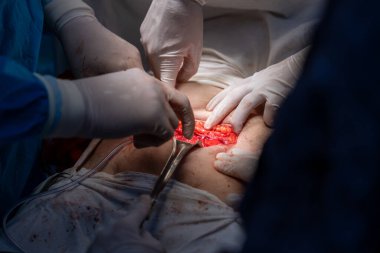 Bir cerrah bir hastanın midesini kesiyor. Cerrah ve diğer tıp uzmanları hastanın hayatını kurtarmak için birlikte çalışırken sahne yoğun ve dramatik.