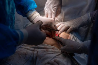 Bir grup cerrah bir hastaya ameliyat yapıyor. Cerrahlar görevlerine odaklandığı için sahne yoğun ve ciddi. Hasta masanın üzerinde yatıyor.