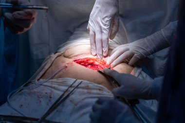 Bir cerrah bir insanın karnını deşiyor. Cerrah ve diğer tıp uzmanları hastanın hayatını kurtarmak için çalışırken sahne yoğun ve dramatik.