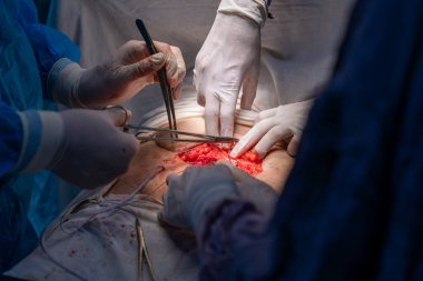 Bir grup cerrah bir hastaya ameliyat yapıyor. Cerrahlar görevlerine odaklandığı için sahne yoğun ve ciddi. Hasta savunmasız bir durumda.