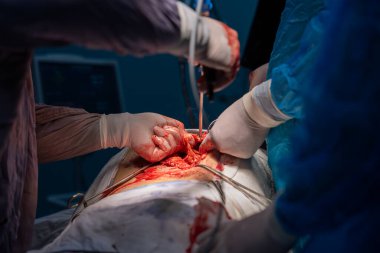 Bir grup cerrah bir hastaya ameliyat yapıyor. Cerrahlar görevlerine odaklandığı için sahne yoğun ve ciddi. Hasta masanın üzerinde yatıyor.