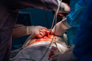 Bir grup cerrah bir hastaya ameliyat yapıyor. Cerrahlar görevlerine odaklandığı için sahne yoğun ve ciddi. Hasta savunmasız bir durumda.