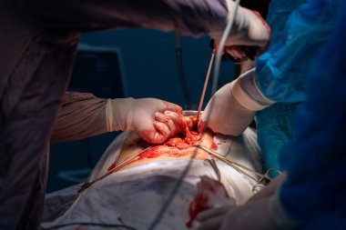 Bir grup cerrah bir hastaya ameliyat yapıyor. Cerrahlar görevlerine odaklandığı için sahne yoğun ve ciddi. Hasta çok acı çekiyor.