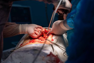 Bir cerrah bir hastanın midesini kesiyor. Cerrah ve diğer tıp uzmanları hastanın hayatını kurtarmak için birlikte çalışırken sahne yoğun ve dramatik.