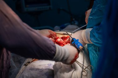 Bir cerrah neşterle bir cesedi kesiyor. Cerrah hayat kurtaran bir prosedür uygularken sahne yoğun ve dramatik.