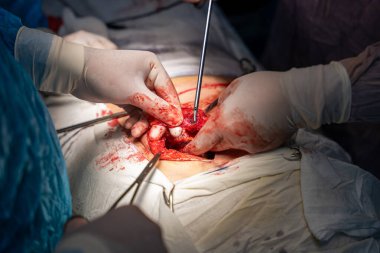 Bir cerrah bir hastanın midesini kesiyor. Cerrah ve diğer tıp uzmanları hastanın hayatını kurtarmak için birlikte çalışırken sahne yoğun ve dramatik.