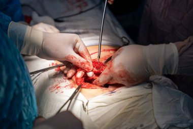 Bir cerrah bir hastanın midesini kesiyor. Cerrah ve diğer tıp uzmanları hastanın hayatını kurtarmak için birlikte çalışırken sahne yoğun ve dramatik.