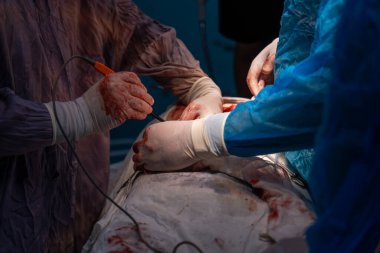 Bir cerrah bir hastanın vücudunu kesiyor. Cerrahlar hastanın hayatını kurtarmak için çalışırken sahne yoğun ve dramatik.