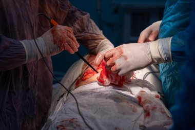 Bir grup cerrah bir hastaya ameliyat yapıyor. Cerrahlar hastanın hayatını kurtarmak için birlikte çalışırken sahne yoğun ve dramatik.