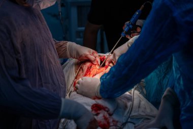 Bir grup cerrah bir hastaya ameliyat yapıyor. Cerrahlar görevlerine odaklandığı için sahne yoğun ve ciddi. Hasta masanın üzerinde yatıyor.