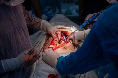 Bir cerrah bir hastanın midesini kesiyor. Cerrahlar hastanın hayatını kurtarmak için çalışırken sahne yoğun ve dramatik.