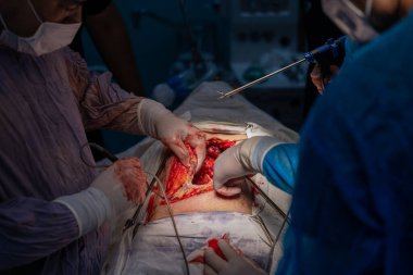 Bir cerrah bir hastanın midesini kesiyor. Diğer cerrahlar ona yardım ediyor. Cerrahlar hayat kurtaran bir ameliyat yaparken sahne yoğun ve ciddi.