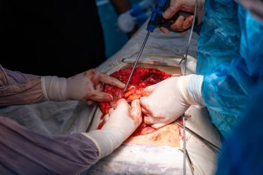 Bir grup cerrah bir hastaya ameliyat yapıyor. Cerrahlar görevlerine odaklandığı için sahne yoğun ve ciddi. Hasta çok acı çekiyor.