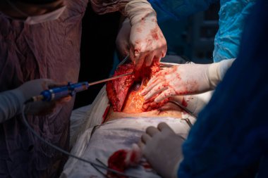 Bir grup cerrah bir hastaya ameliyat yapıyor. Cerrahlar hastanın hayatını kurtarmak için çalışırken sahne yoğun ve dramatik.