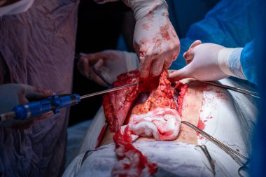 Bir cerrah bir hastanın midesini kesiyor. Olay yeri kanlı ve yoğun. Cerrah ve diğer tıp uzmanları hastanın hayatını kurtarmak için birlikte çalışıyorlar.