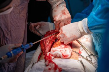 Bir cerrah bir hastanın midesini kesiyor. Cerrah ve diğer tıp uzmanları hastanın hayatını kurtarmak için birlikte çalışırken sahne yoğun ve dramatik.