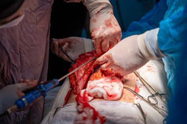 Bir cerrah bir hastanın midesini kesiyor. Olay yeri kanlı ve yoğun. Cerrah ve diğer tıp uzmanları hastanın hayatını kurtarmak için birlikte çalışıyorlar.