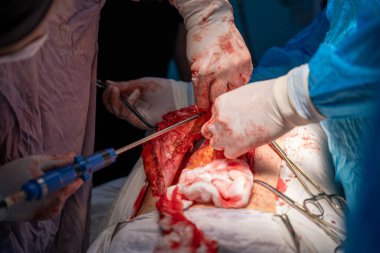 Bir cerrah neşterle bir cesedi kesiyor. Cerrah ve diğer tıp uzmanları hassas bir performans sergilemek için birlikte çalışırken sahne yoğun ve dramatik. Aciliyet ve odaklanma kavramı