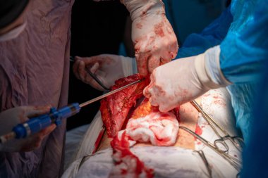 Bir cerrah neşterle bir cesedi kesiyor. Olay yeri kanlı ve yoğun. Cerrah eldiven ve maske takıyor ve odada başkaları da var. Atmosfer gergin ve ciddi.