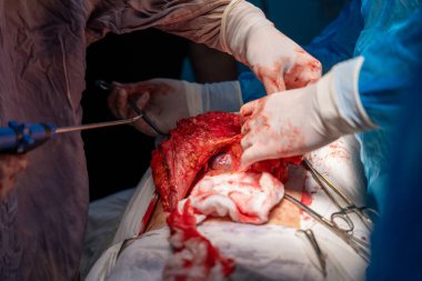 Bir cerrah kanlı bir bezle bir cesedi kesiyor. Cerrah ve diğer tıp uzmanları hastanın hayatını kurtarmak için çalışırken sahne yoğun ve dramatik.