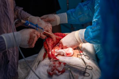 Bir grup cerrah bir hastaya ameliyat yapıyor. Cerrahların hastanın hayatını kurtarmak için birlikte çalıştığı sahne yoğun ve dramatik. Hastanın vücudu kanla kaplı.