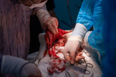 Bir cerrah kanlı bir elle bir cesedi kesiyor. Cerrahın hareketlerine odaklanan sahne yoğun ve dramatik.