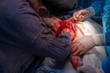 Bir adam bir insanın karnını deşiyor. Adam mavi bir gömlek ve beyaz bir laboratuvar önlüğü giyiyor. Sahne yoğun ve dramatik.