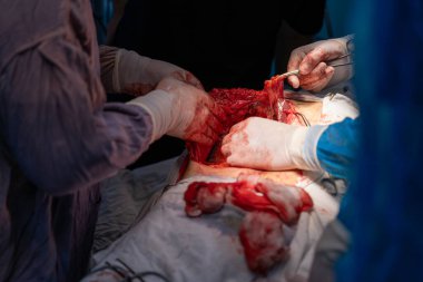 Bir grup cerrah bir hastaya ameliyat yapıyor. Cerrahlar hastanın hayatını kurtarmak için çalışırken sahne yoğun ve dramatik.