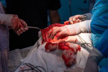 Bir grup cerrah bir hastaya ameliyat yapıyor. Olay yeri yoğun ve dramatik. Cerrahlar hastanın vücudunu kesmek için keskin aletler kullanıyor. Hasta masanın üzerinde yatıyor.