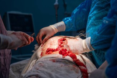 Bir cerrah bir hastanın midesini kesiyor. Olay yeri kanlı ve yoğun. Cerrah ve diğer tıbbi personel birlikte hastanın hayatını kurtarmaya çalışıyor. Sahne ciddi ve acil.