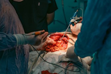 Bir grup cerrah bir hastaya ameliyat yapıyor. Cerrahlar görevlerine odaklandığı için sahne yoğun ve ciddi. Hasta masanın üzerinde yatıyor.