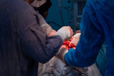 Bir cerrah bir hastanın vücudunu kesiyor. Cerrah ve ekibi hastanın hayatını kurtarmak için çalışırken sahne yoğun ve dramatik.