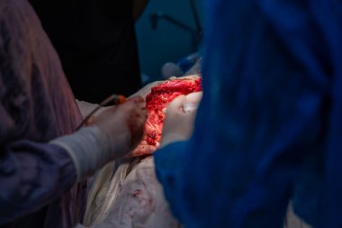 Bir cerrah bir hastanın vücudunu kesiyor. Hastanın kanaması var ve cerrah dokuyu kesmek için neşter kullanıyor. Sahne yoğun ve dramatik.