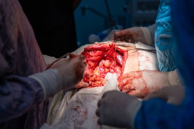 Bir grup cerrah bir hastaya ameliyat yapıyor. Cerrahlar hastanın hayatını kurtarmak için çalışırken sahne yoğun ve dramatik.