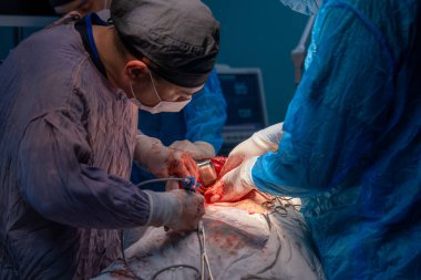 Bir adam bir insanın karnını deşiyor. Odadaki diğer insanlar ameliyat malzemesi giyiyorlar.