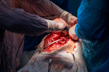 Bir cerrah bir hastanın midesini kesiyor. Olay yeri kanlı ve yoğun. Cerrah ve diğer tıp uzmanları hastanın hayatını kurtarmak için birlikte çalışıyorlar.