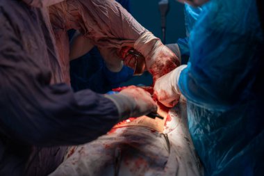 Bir grup cerrah bir hastaya ameliyat yapıyor. Cerrahlar görevlerine odaklandığı için sahne yoğun ve ciddi. Hasta savunmasız bir durumda.