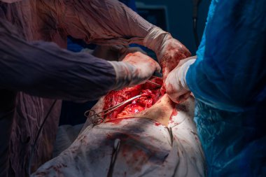 Bir grup cerrah bir hastaya ameliyat yapıyor. Olay yeri yoğun ve dramatik. Cerrahlar hastanın hayatını kurtarmak için birlikte çalışıyorlar.