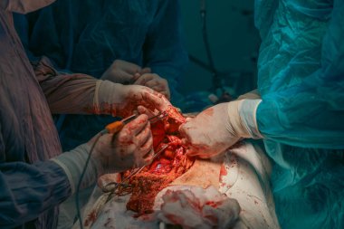 Bir grup cerrah bir hastaya ameliyat yapıyor. Cerrahlar hastanın hayatını kurtarmak için birlikte çalışırken sahne yoğun ve dramatik.